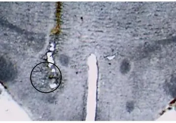 Figure 1. Photograph of the coronal section of a rat brain  representing the injection site of 6-OHDA in the medial  forebrain bundle (open circle).