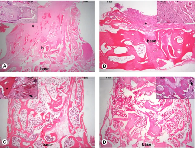 Figure 2. Representative histological sections for autogenous (A), blood clot (B), fresh-frozen (C), and DFDBA (D) groups (haematoxylin-eosin, 25X  and 400X original magnification, scale bar = 1 mm and 50µm, respectively)