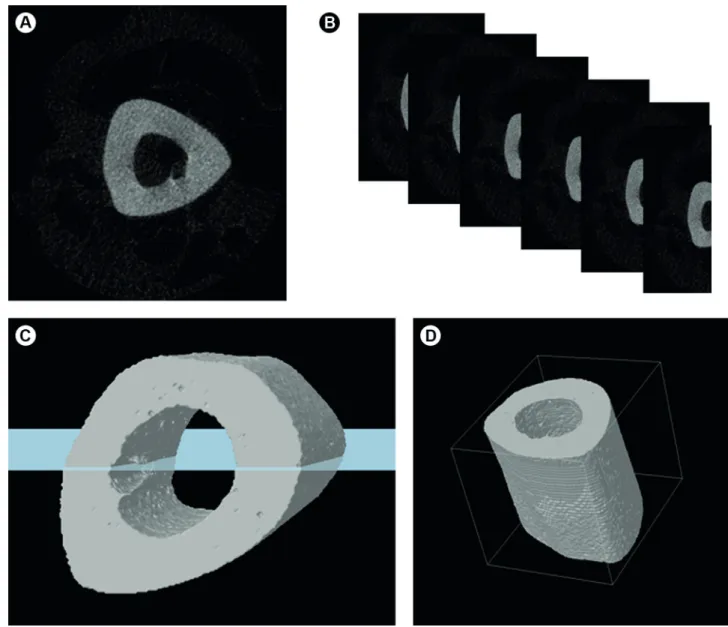 Figure 2. Rat tibiae scanned at the diaphysis in order to evaluate the cortices (15 µm pixel size at 90 kV, 111 µA and 1800 ms integration time; 
