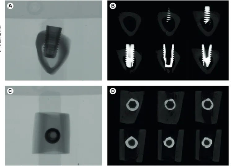 Figure 3. Implant installed in a rabbit tibia (8.5 µm pixel size at 90 kV, 278 µA and 1320 ms integration time; rotation step 0.400 and Filter Cu  0.1 mm; Reconstruction: Smoothing=2, Smoothing kernel=0 (Asymmetrical boxcar), Ring Artifact Correction=8 and
