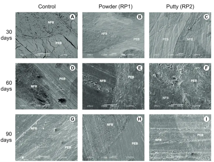 Figure 4.  Post-implantation SEM micrographs of the periphery of the bone defects: at 30 days (A) control, (B) RP1, (C) RP2; 60 days (D) control,  (E) RP1, (F) RP2; 90 days (G) control, (H) RP1, (I) RP2, showing the presence of newly formed bone (NFB) and 