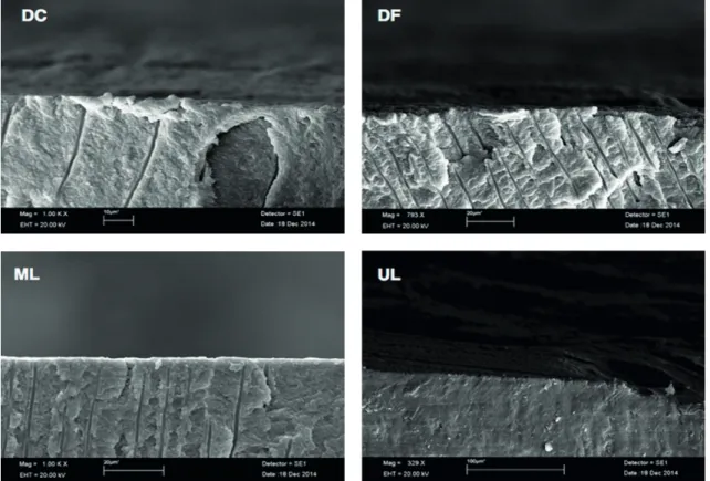 Figure 2. SEM micrographs of bonding interface with RelyX ARC. Coarse diamond bur (DC), Fine diamond bur (CF), Multi laminate diamond bur  (ML) and Ultrasonic diamond bur (UL)