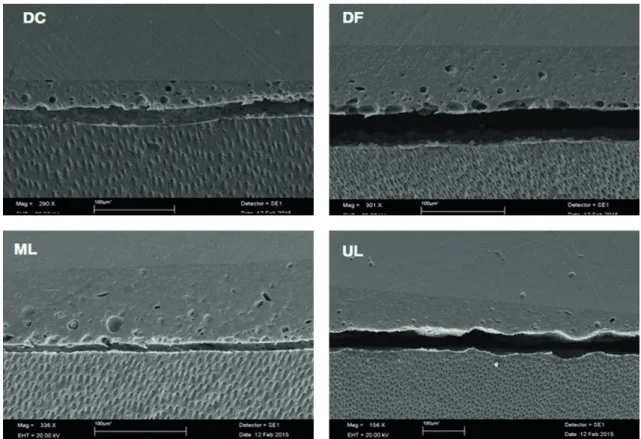 Figure 3. SEM photomicrographs of bonding interface with Rely XU200. Coarse diamond bur (DC), Fine diamond bur (CF), Multi laminate  diamond bur (ML) and Ultrasonic diamond bur (UL)