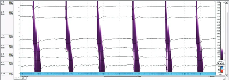 FIGURE 2.  Analysis of the bolus transport.