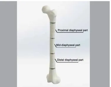 Figure 4. Level of the subsequent fracture. Femoral diaphysis was divided  equally into proximal, mid and distal diaphyseal parts.