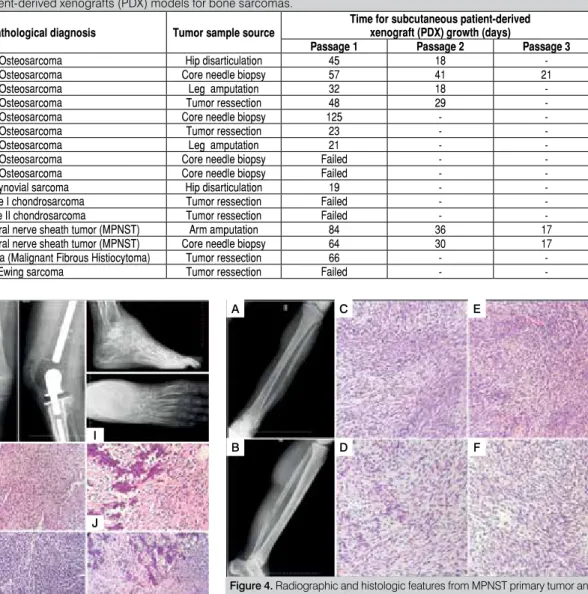 Table 2. Characteristics of patient-derived xenografts (PDX) models for bone sarcomas.