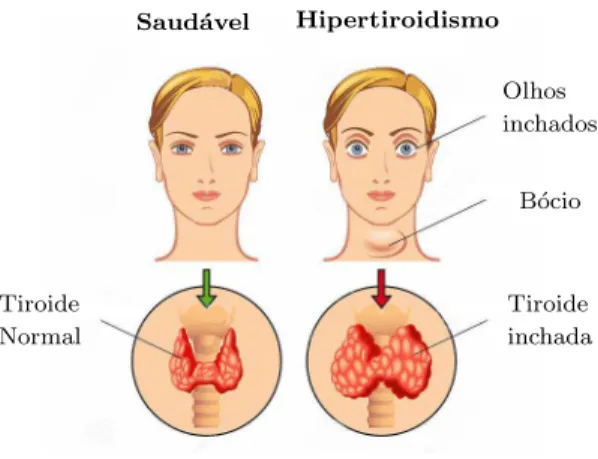Figura 2.4 – Produ¸c˜ ao de hormonas da tiroide (Adaptado de Mnemotecnias (2018)).