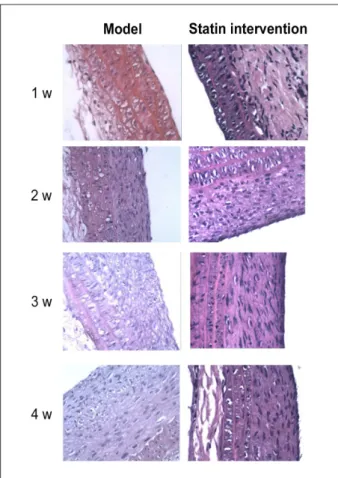 Figure 3 – Hematoxylin-eosin (HE) staining in the model group and in  intervention group 1 week (w), 2 weeks, 3 weeks and 4 weeks after balloon  injury of rat carotid arteries; magnification 400×.