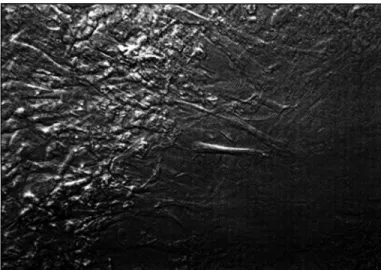 Fig.  2  - Mlcrophotograph  24  hours  after  exclmer  laser  ablation:  the  keratocytes already cover the perlphery of the ablated area and mlgrate 