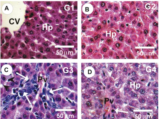 FIGURE 1  - Photomicrographs of rat liver sections stained by HE; (A&amp;B) Rat testes in control (G1) and GSPE (G2) groups  showed normal architecture of the hepatocytes (hp) with central vien (CV);  (C) Liver sections of Gleevec group (G3) exhibited  mar