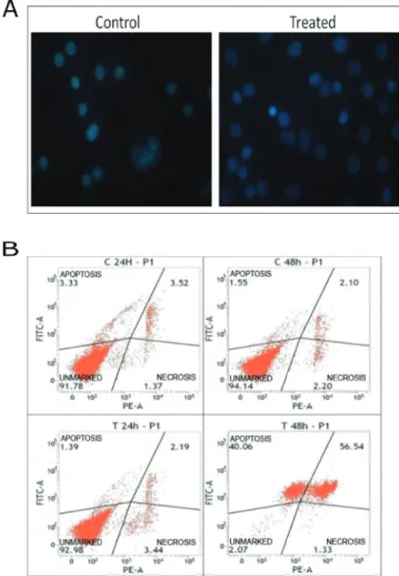 FIGURE 5  - (A) Analysis of nuclear morphology in fluorescence  microscope using Hoechst® 33258 dye (at 1 μg/mL) in SiHa  cells treated with the E