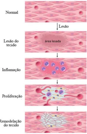 Figura  1:  Representação  esquemática  do  mecanismo  de  reparação  da  pele  -  após  a  hemóstase, o local lesionado permanece inflamado durante algum tempo, de forma a promover  a  proliferação  de  células  responsáveis  pela  regeneração  do  tecido