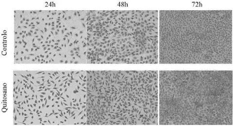 Figura  7:  Efeito  da  adição  de  quitosano  na  propagação  de  fibroblastos  de  ratinhos  após  incubação  durante  24h,  48h  e  72h