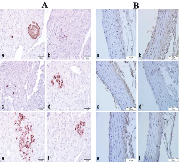 FIGURE 2  - A:  Pancreas, insulin/proinsulin immunohistochemistry a) Normoglycemic Control group: strong immunoreactivity  in the islet of Langerhans, e) Diabetes group: Weak immunoreactivity in few cells, c-e) Diabetes + Extract groups; 500, 1000 and  150