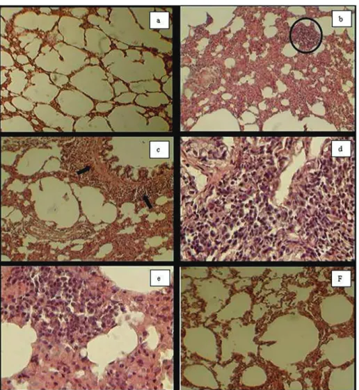 FIGURE 5  - The histopathological studies of lung sections viewed under a light microscope (hematoxylin and eosin [H&amp;E] staining)  in the control and experimental groups