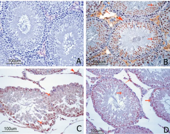FIGURE 2  -  GPx1 immunolocalization in cross-sections of the rat testes. (A) The negative control showed no GPx1 staining