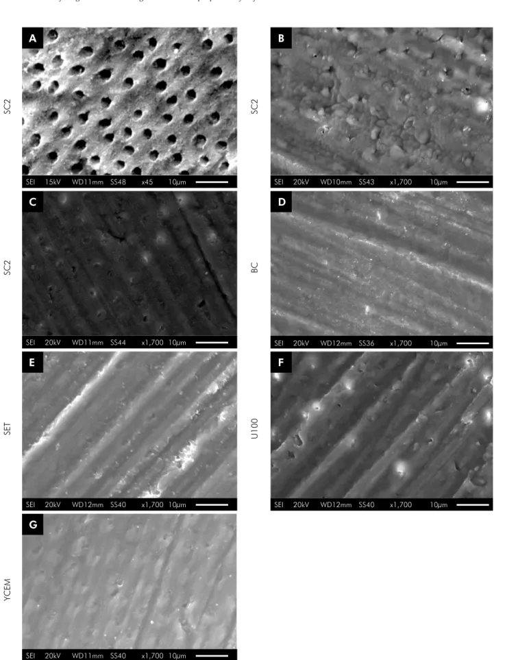 Figure 3. SEM micrographs comparing the demineralization pattern on dentin and the morphology created by acid monomers  from SARCs (C – G), using phosphoric acid 37% as positive control (A) and wet polished specimens as negative control (B)