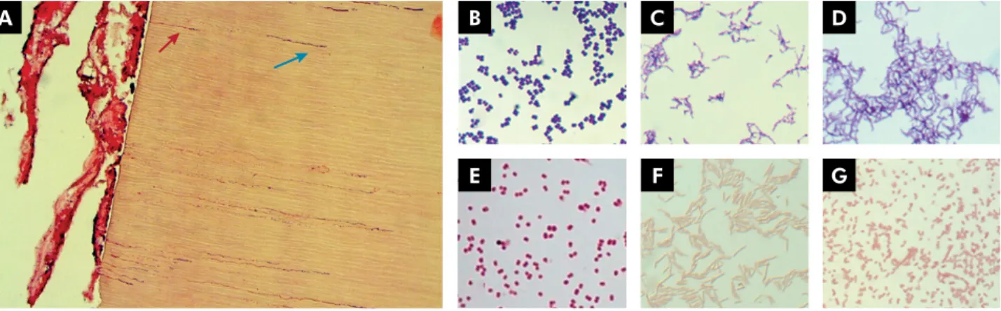 Figure 1 shows bacterial penetration into dentinal  tubules and examples of Gram staining morphology.