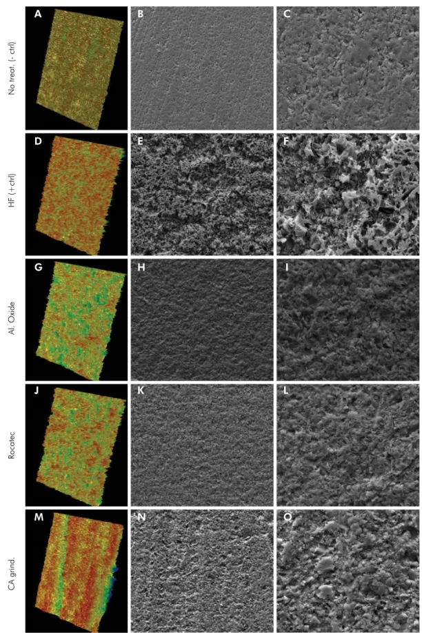 Figure 2. 3D profilometry images (A, D, G, J, M) and micrographs 1000x (B, E, H , K N), 3000x (C, F, I L, O) of the hybrid ceramic  after surface treatments
