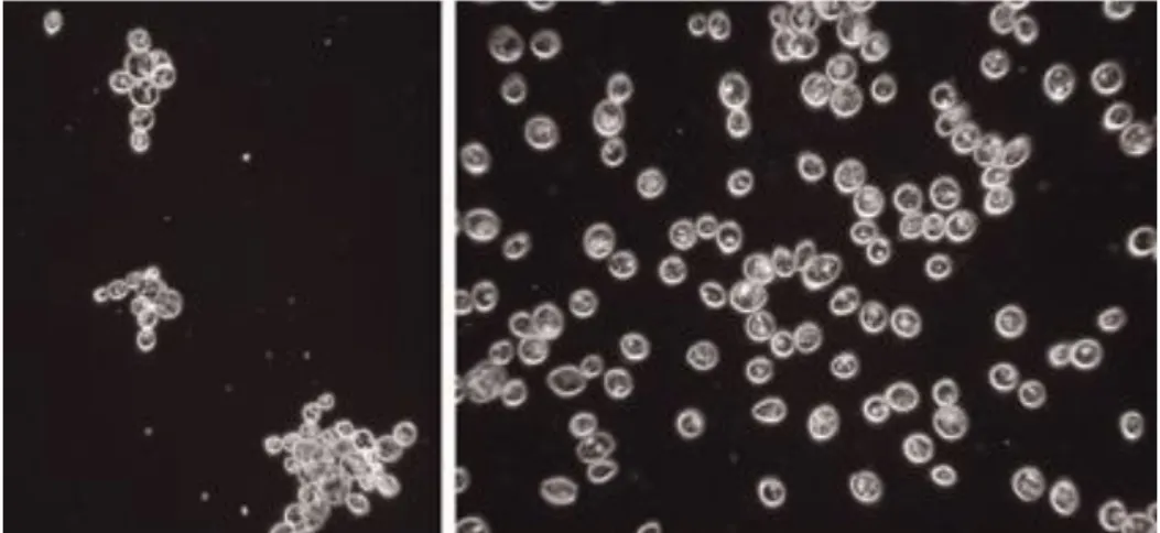 Ilustração 1 – Imagens de microscopia de leveduras de fermentação de topo (à esquerda) e de fermentação baixa  (à direita)