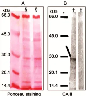 Figure  3  Western  blot  analyses.  (A)  The  Ponceau  staining  shows  1  µg  of  total  proteins  extracted  from  inflamed  joints  of  CIA  mice  (§)  separated  by  10%   SDS-PAGE