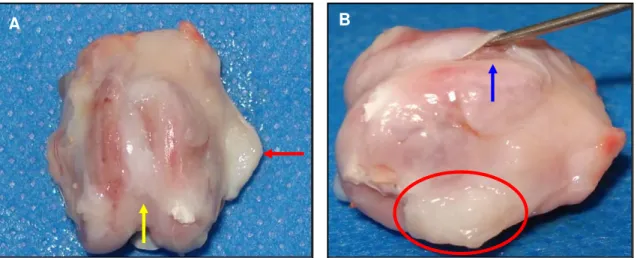 Figura 10. Em “A” e “B”, sulco troclear femoral do coelho grupo tratado com células mononucleares  CT11, após 90 dias de PO