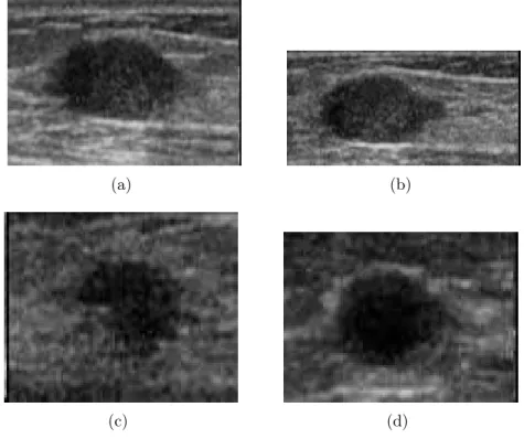 Figura 1.4: Exemplos de imagens com ruído speckle.