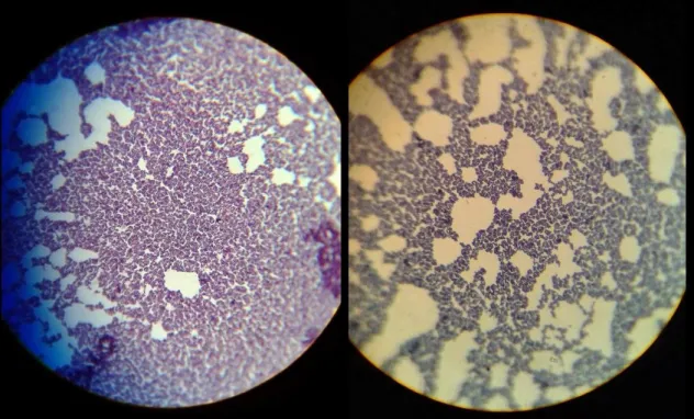 Figura 2: Staphylococcus spp. visto ao microscópio, resolução 100/1.25, sendo possível visualizar a sua  forma (cocos), assim como uma coloração violeta devido à capacidade de retenção do cristal violeta de 