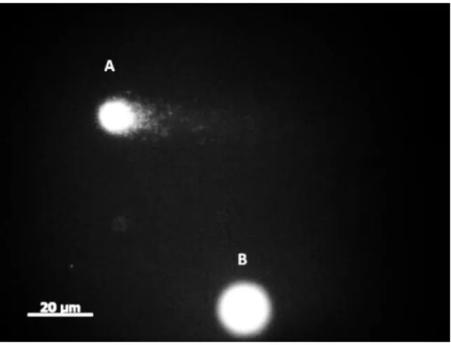 Figure  1  Fluorescent  micrograph  of  comet  assay  from  lymphocytes  stained  with  ethidium  bromide