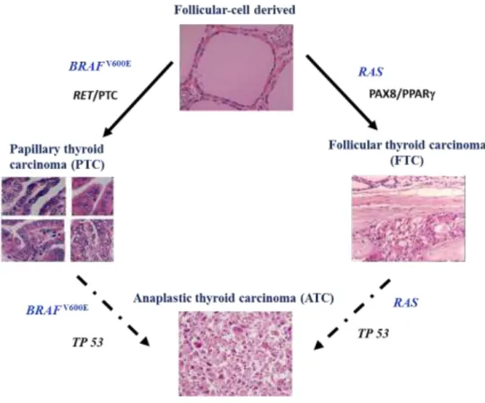Figure 1.5: Schematic representation of involvement of the MAPK-ERK and PI3K-AKT pathways  in  the  follicular  cell  derived thyroid tumorigenesis