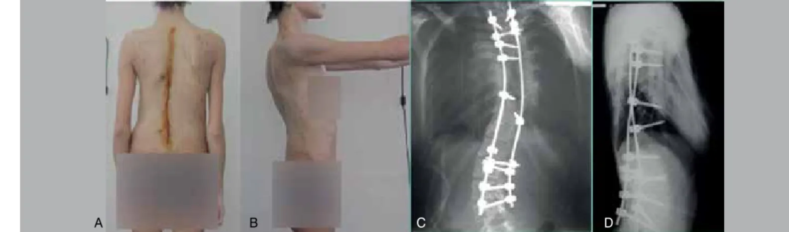 Figure 3. Appearance (A, B) and radiographs (B, C) of the patient after treatment.