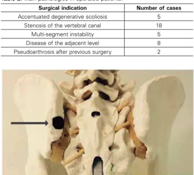 Table 1. Levels of instrumentation of patients in the study.