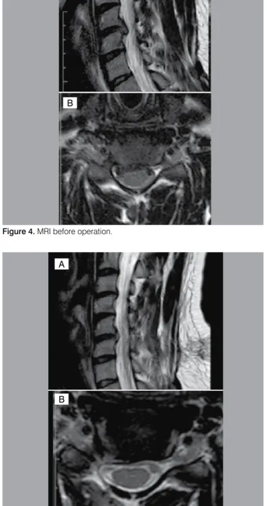 Figure 5. MRI after operation.