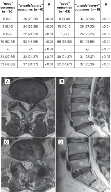 Figure 3. Patient G., 39 years old. MRI of the lumbosacral spine, T2 weighted  images: A - axial projection: angulation of FJ - 63 o , no tropism; B - sagittal  projection (arrow indicates Hernia of IVD L V -S I ); C - axial projection after  sur-gery in t