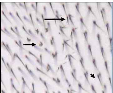 Figura 6. Fotomicrografia, com microscópio óptico de luz (aumento de  400X), com apresentação de pêlos múltiplos - mwh (seta maior), de  pêlos flare (seta média) e de pêlos normais (seta menor)