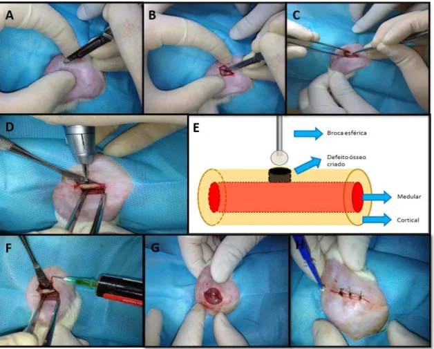 Figura 1. Imagens mostrando a sequência cirúrgica. A - Local da incisão na  região  lateral  do  fêmur