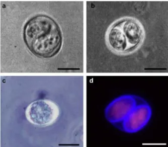 Figura 2. Imagens de oocistos de  T. gondii isolado de fezes de gado (A e B) Cópia da  micrografia  original  mostrando  a  estrutura  original  de  “novos  cistos”  (oocisto)  de  T