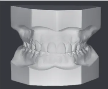 Figure 1 - Dental cast.
