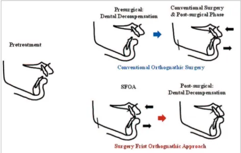 Figure 1 - Various approaches for the treatment  of skeletal deformity.
