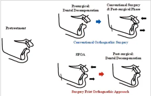 Figure 1 - Various approaches for the treatment  of skeletal deformity.