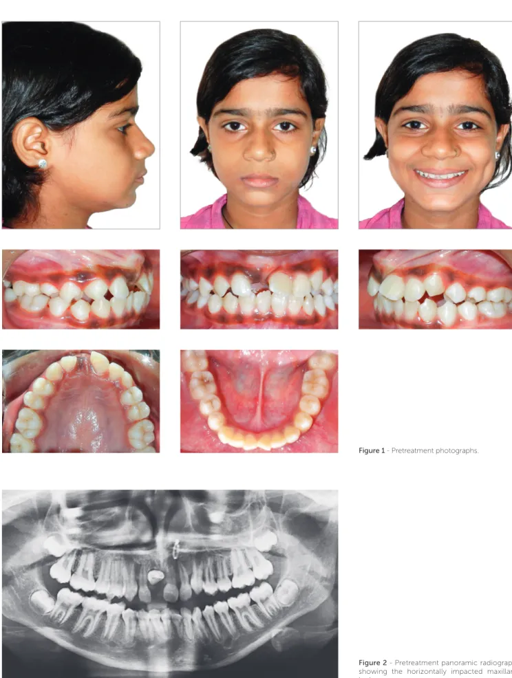 Figure 1 - Pretreatment photographs.