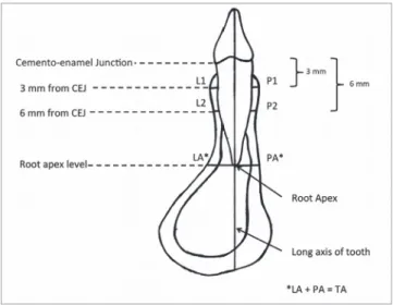 Figure 2 - Sagittal cross-section of the lower anterior tooth. 