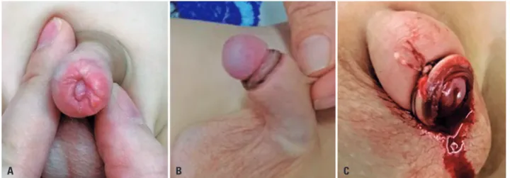 Figure 2. Postoperative complications