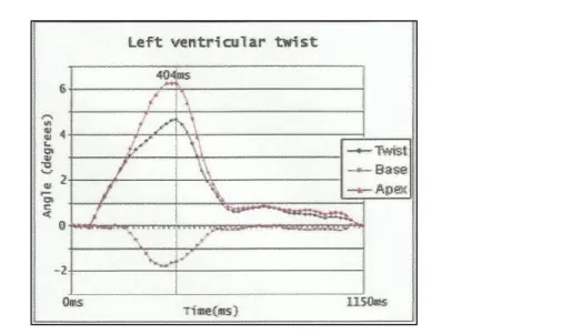 Figura 4 - Representação do cálculo da torção. Linha negativa- Rotação basal. Linha positiva  rosa  -  Rotação  apical