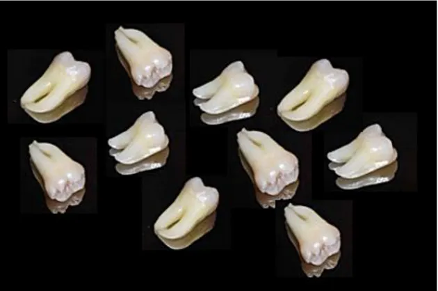 Figura 1. Exemplo dos dentes selecionados. 