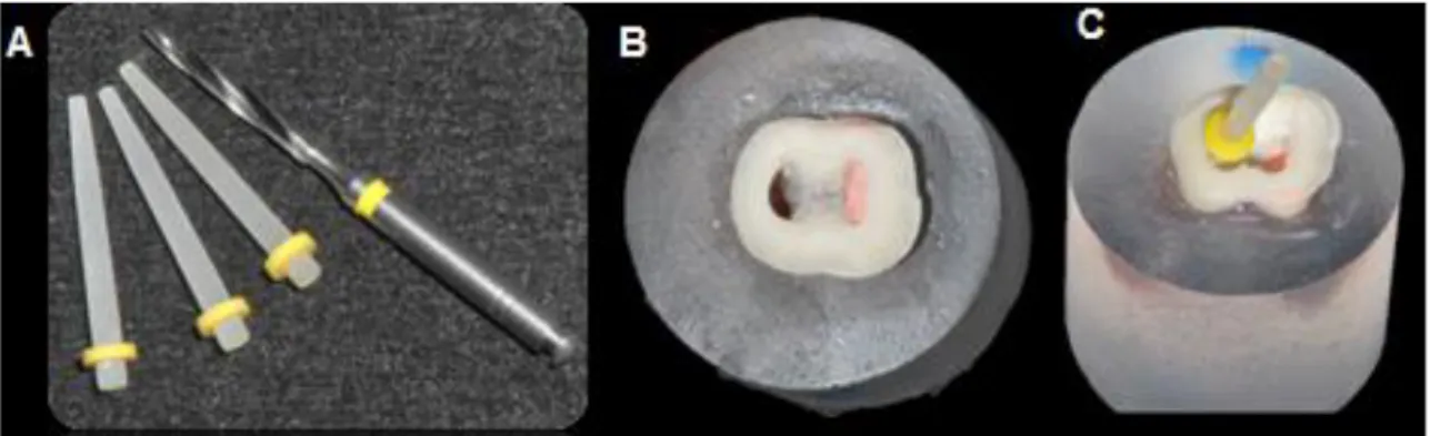 Figura 6. A. Broca calibradora e pino de fibra de vidro liso cilíndrico-cônico N°2  Exacto,  Angelus;  B