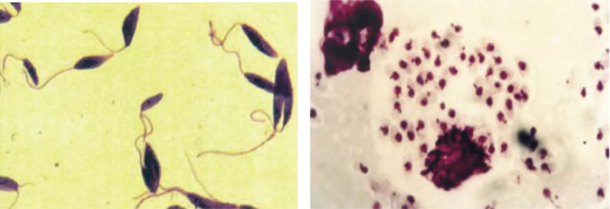 Figura 1.  Leishmania sp.: forma promastigota, flagelada (à esquerda) e forma amastigota,  aflagelada (à direita)