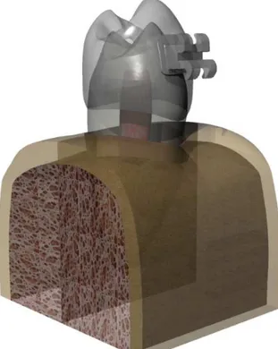 Figura 4.  Geração de modelo hígido baseado nos principais marcos anatômicos  e com auxílio de ferramenta específica do programa (Superfícies NURBS)