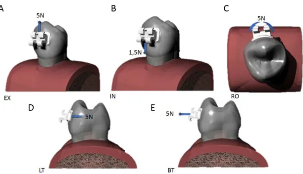 Figura 7. Forças e tipos de carregamentos aplicados: A – Extrusão, B – Intrusão,  C – Giroversão, D – Palatinização e E - Vestibularização