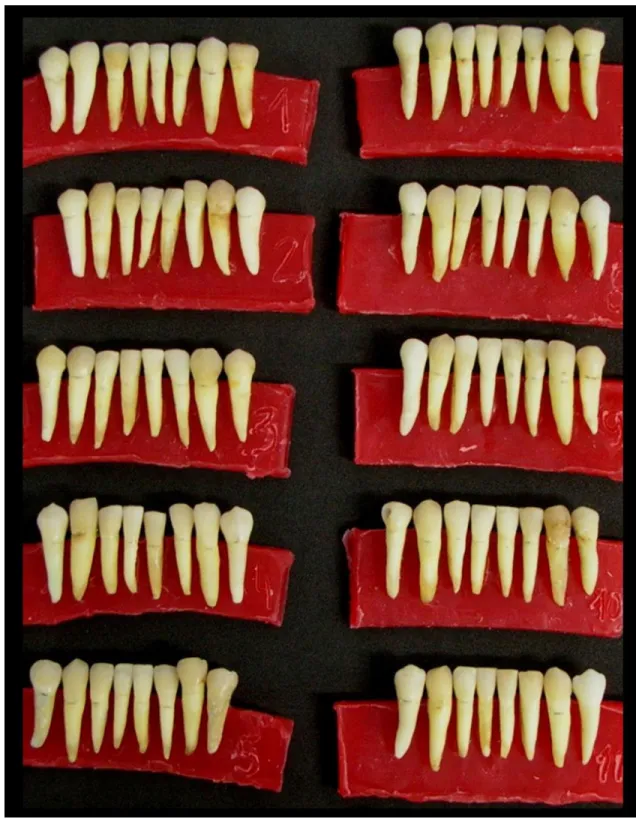 Figura 1.  Dentes inferiores humanos hígidos selecionados para a pesquisa  após análise dos critérios de inclusão e exclusão